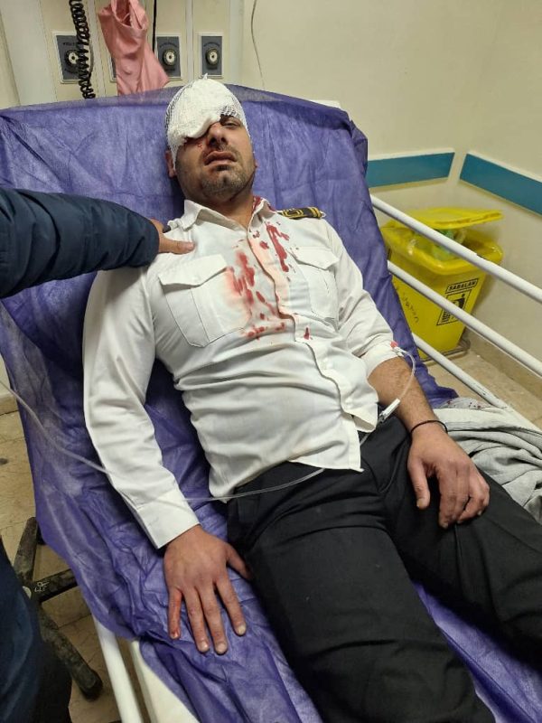 حمله همراه بیمار با سلاح سرد باعث نابینا شدن چشم نیروی حراست بیمارستان ۲۲ بهمن شد